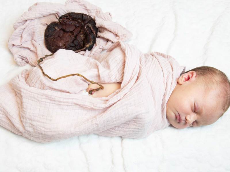 Bei der Lotusgeburt wird das Baby nicht von der Nabelschnur getrennt.