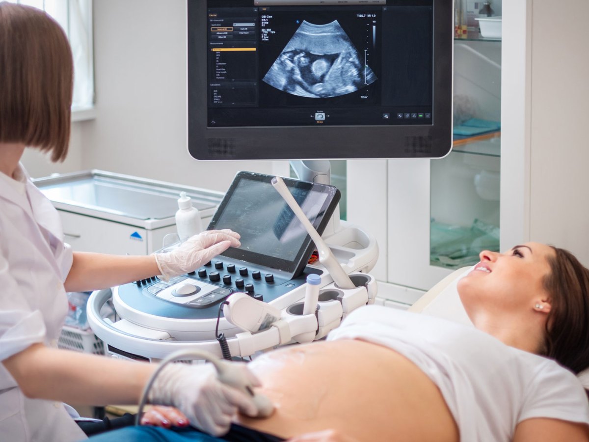 Frau auf einer Liege bekommt einen Ultraschall von einer weiteren Frau. Beide schauen gespannt auf den Bildschirm.
