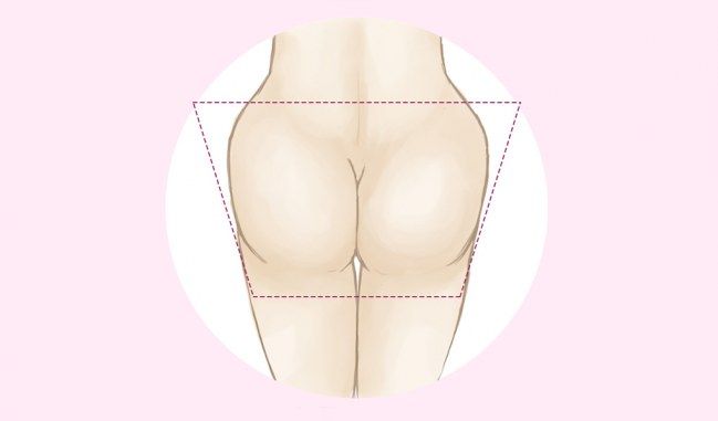 Po-Formen: Der V-förmige Po