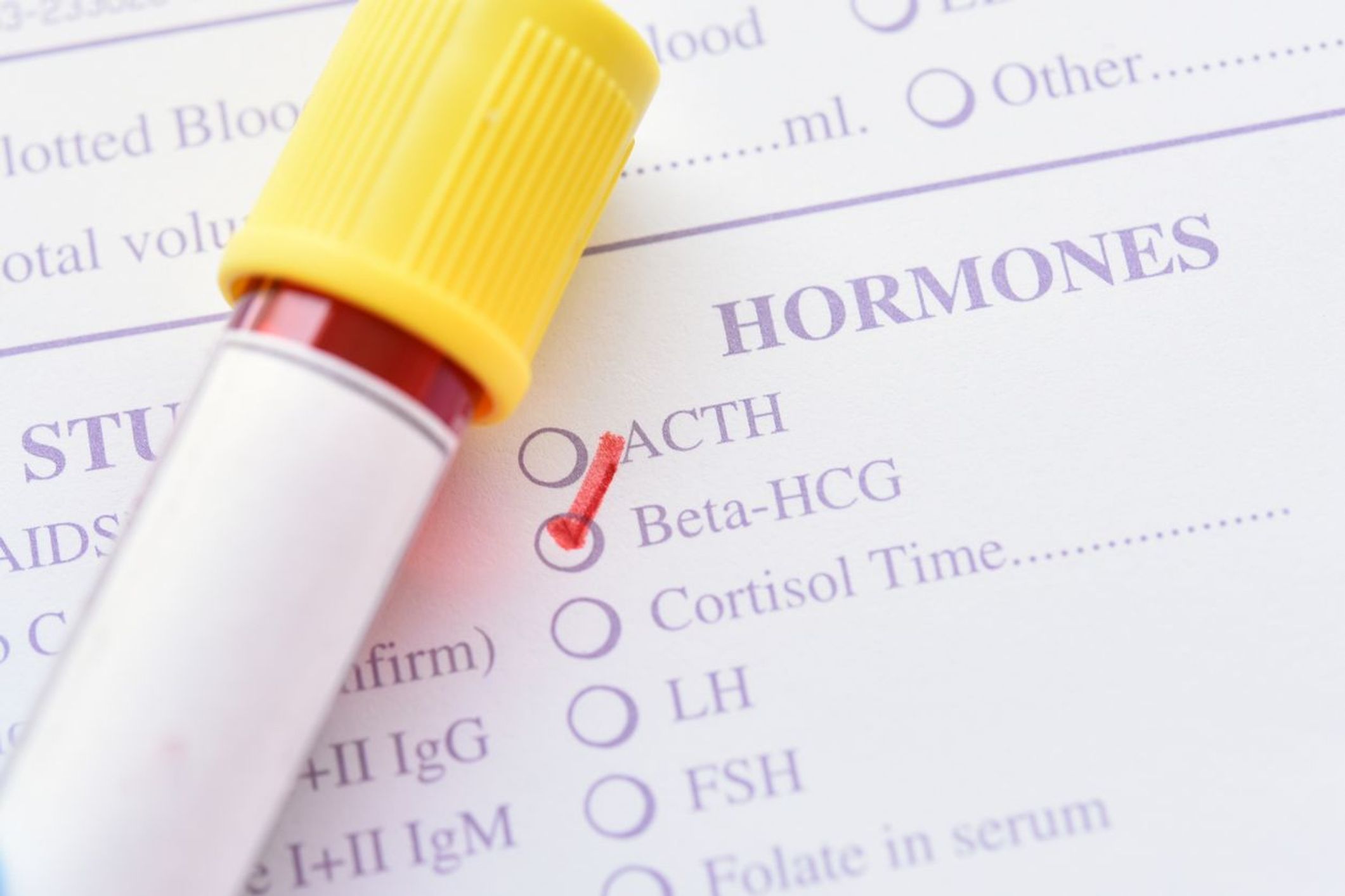 Schwangerschaft: Das verrät der Beta-hCG-Bluttest Schwangerschaft: Das verrät der Beta-hCG-Bluttest
