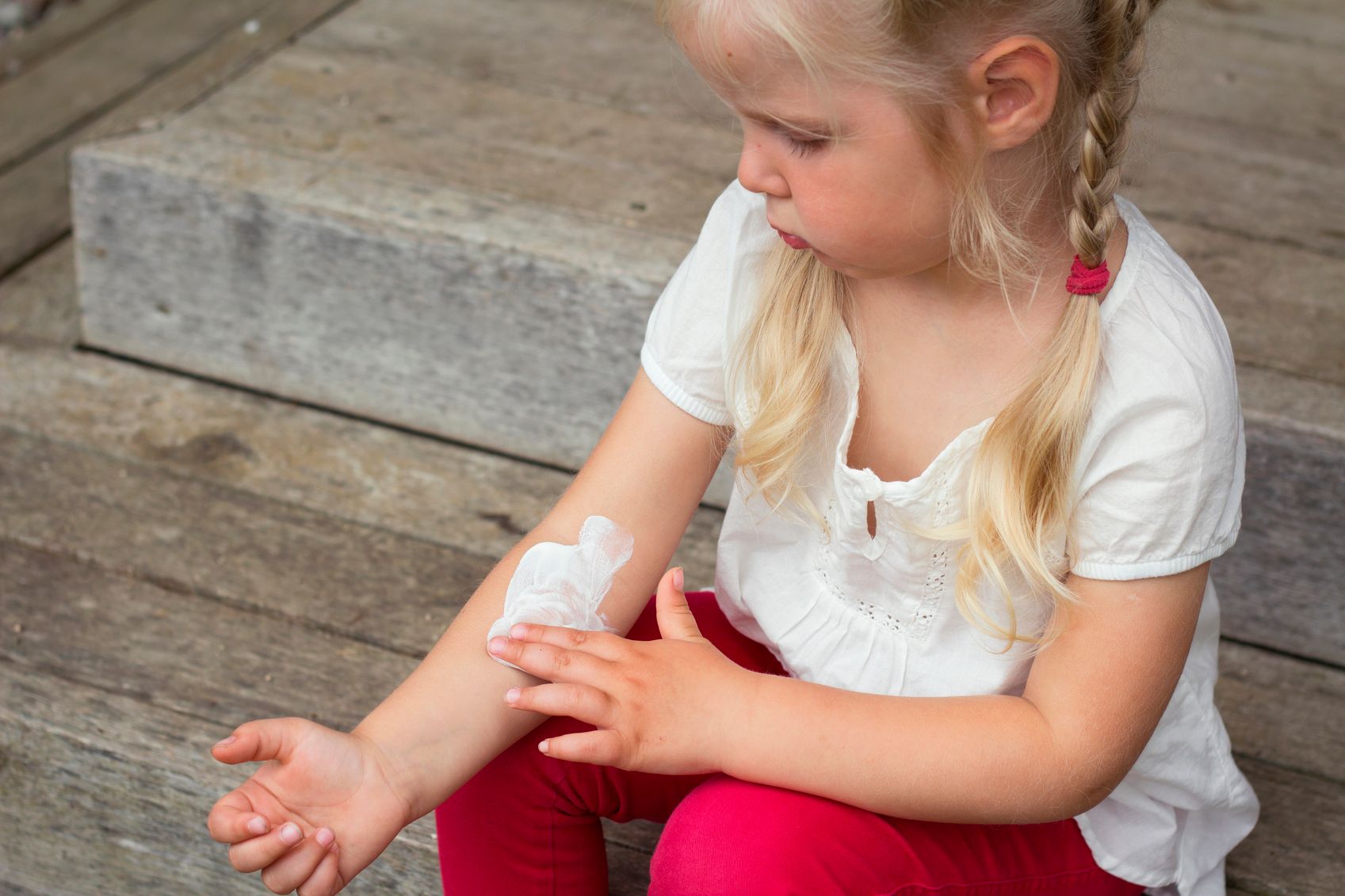 Neurodermitis: Bei Kindern oft in Knie- und Ellenbeugen.