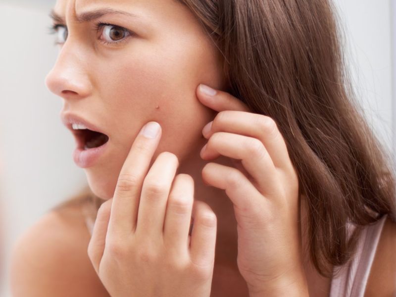 Tipps gegen Pickel: Von Hausmitteln bis Make-up Tipps