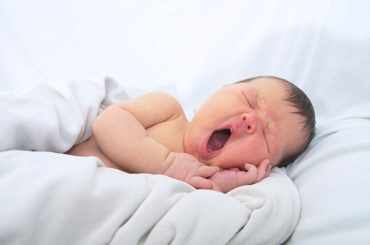 Gelbsucht bei Babys: Was du wissen musst