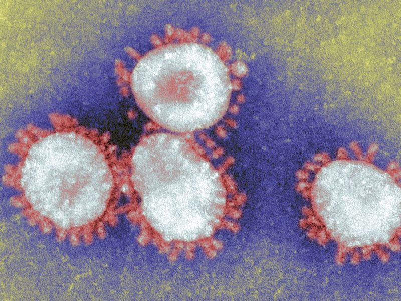 Coronavirus: Was ist das?