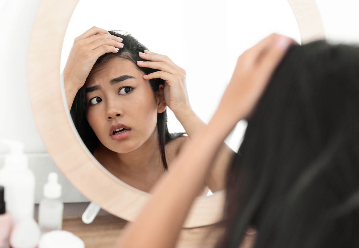 Diese SOS-Tipps helfen gegen lichter werdendes Haar an den Schläfen.