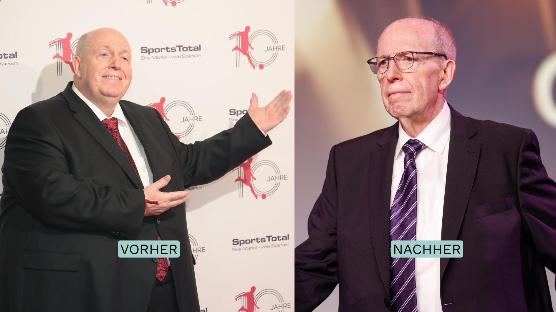 Reiner Calmund vor und nach seiner Magenoperation Reiner Calmund vor und nach seiner Magenoperation