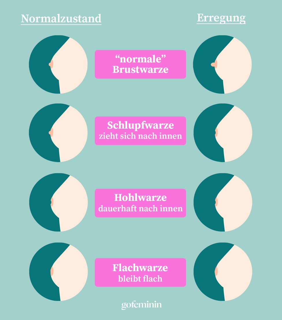 Schlupfwarzen Ursachen und Bedeutung der Brustwarzenform gofeminin