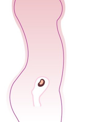 Entwicklung-Embryo, Entwicklung-Baby: 10 SSW (Schwangerschaftswoche)
