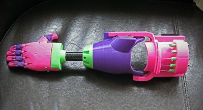 Isabellas neue Hand