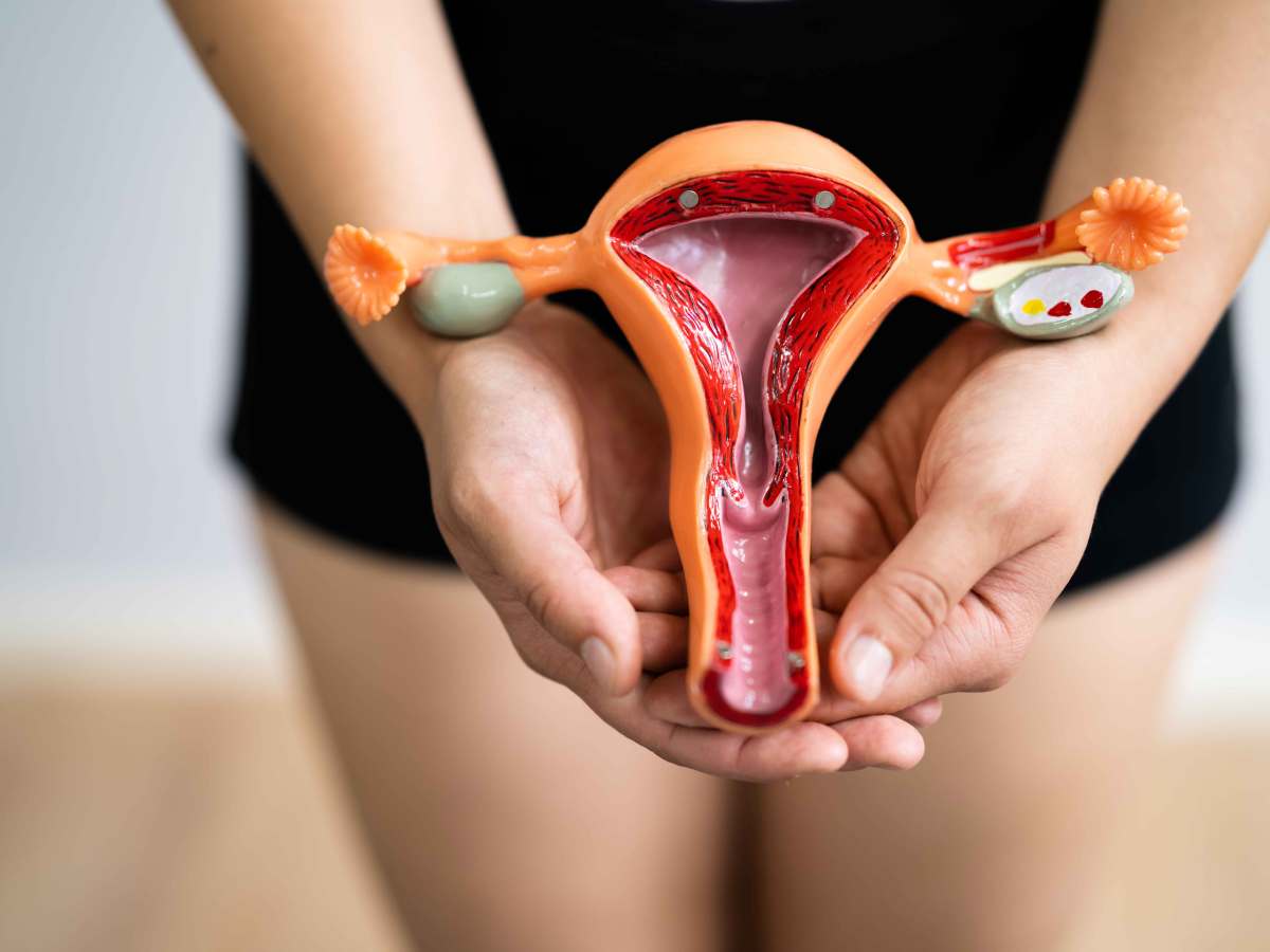 Model einer Gebärmutter mit Eierstöcken, das von einer Frau gehalten wird.