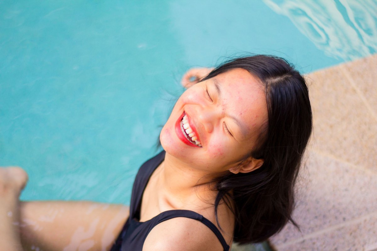 Schöne Frau beim Sonnenbaden mit unreiner Haut.