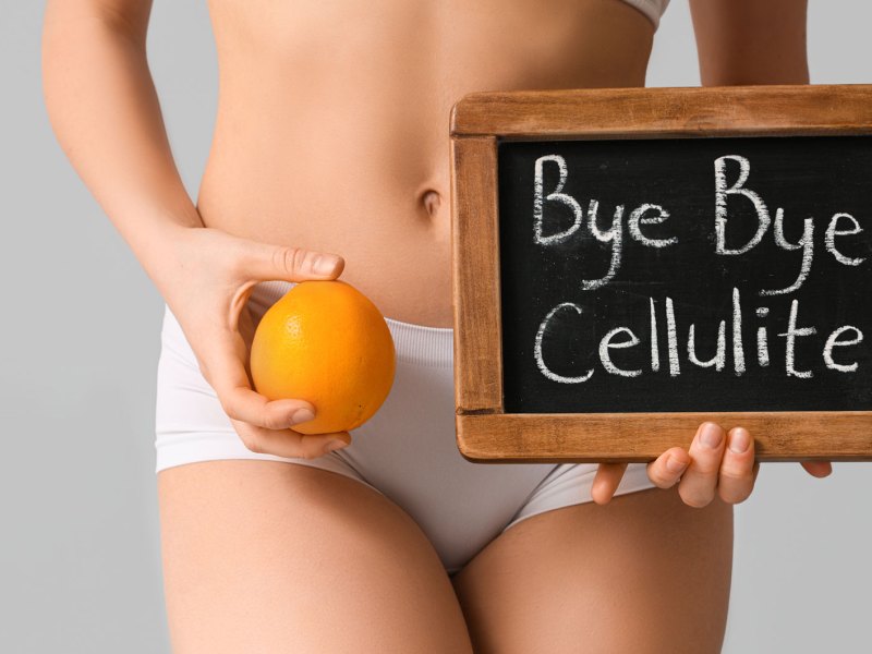Frau, die ein Schild mit "Bye, bye Cellulite" in der Hand hält